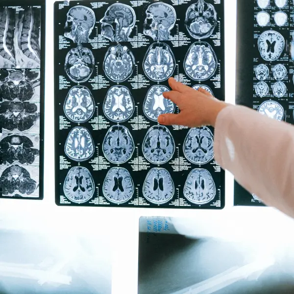 Hand touching medical imaging scans
