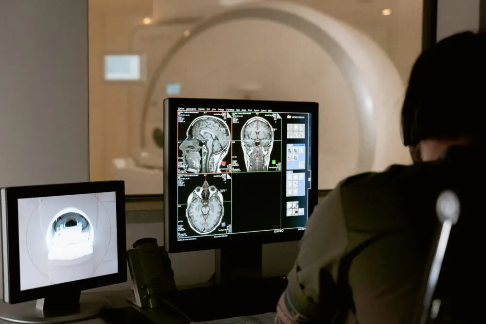 An image of an MRI machine with MRI images of a head on a screen