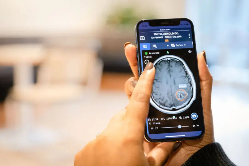 Photo of Bleepa in use mobile phone view of brain MRI in users hands