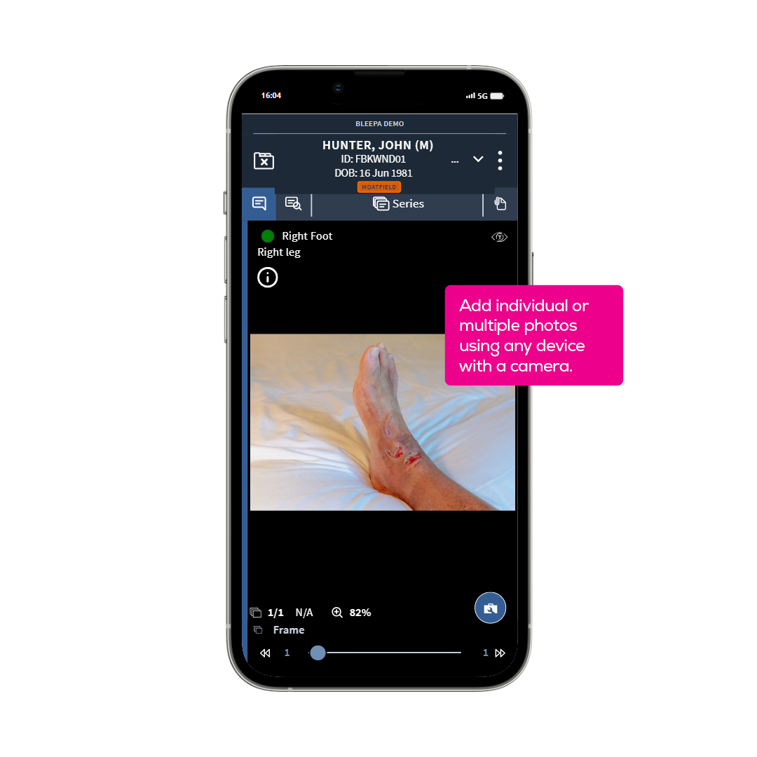 Screenshot of Bleepa mobile view showing photo captured of injured foot
