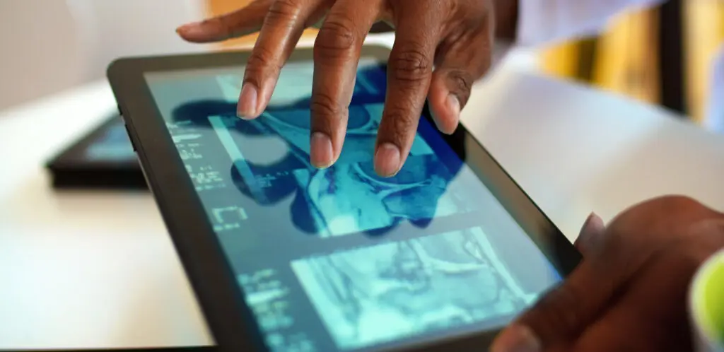 Closeup of doctor looking at xrays and CAT scan on digital tablet.